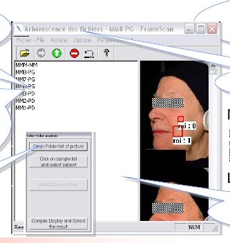 皮肤图像分析软件的图片