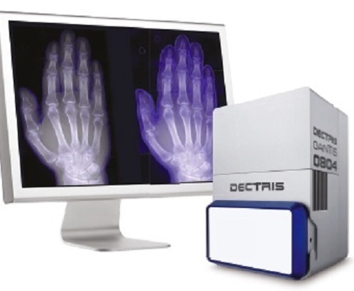 DECTRIS双能混合光子计数X射线探测器的图片