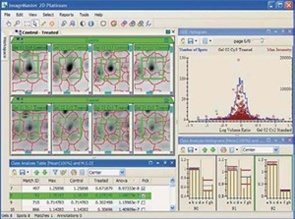 ImageMaster 2D Platinum分析软件的图片